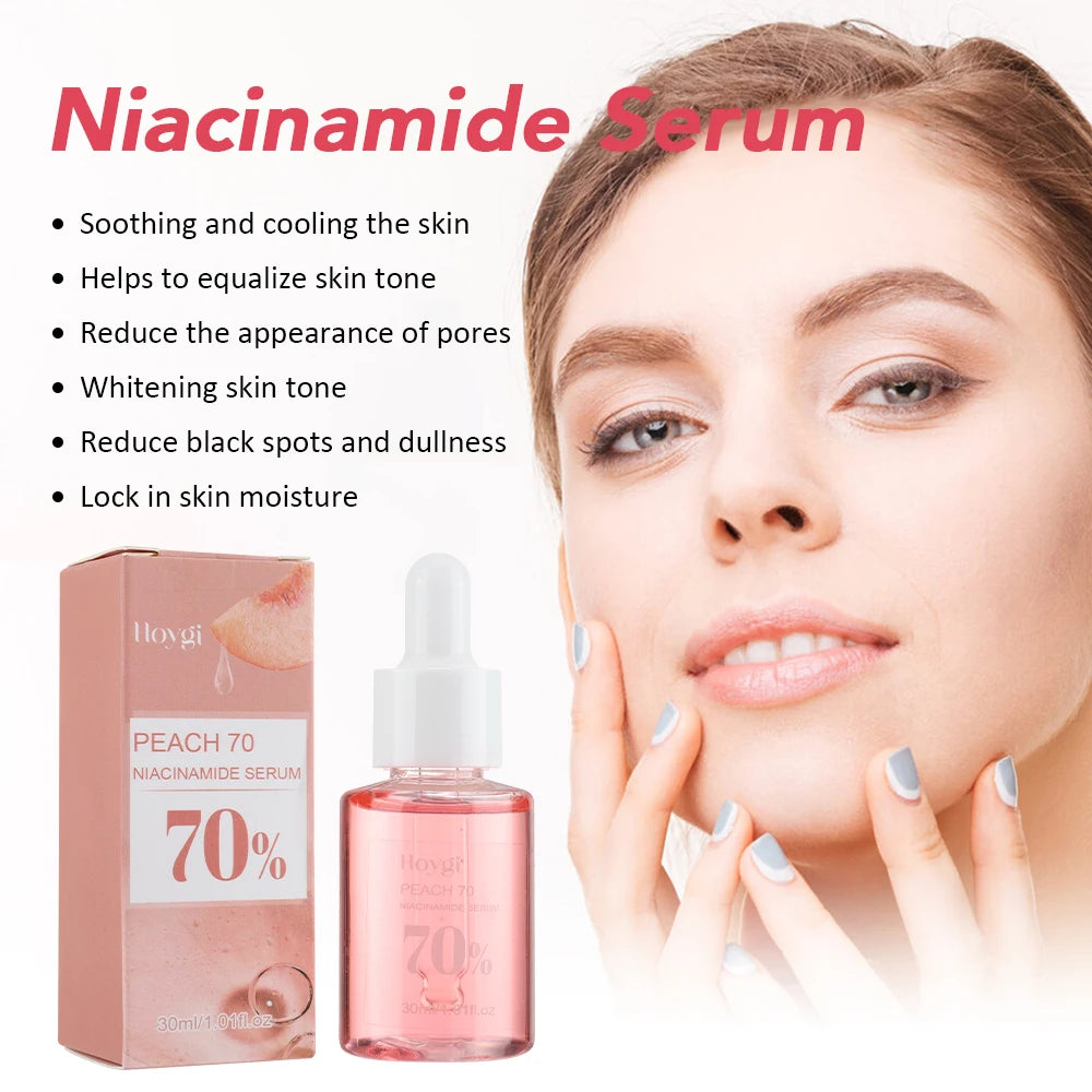 Niacinamide Face Serum 30ml – Dark Spot Corrector, Pore Minimizer & Brightening Skin Care