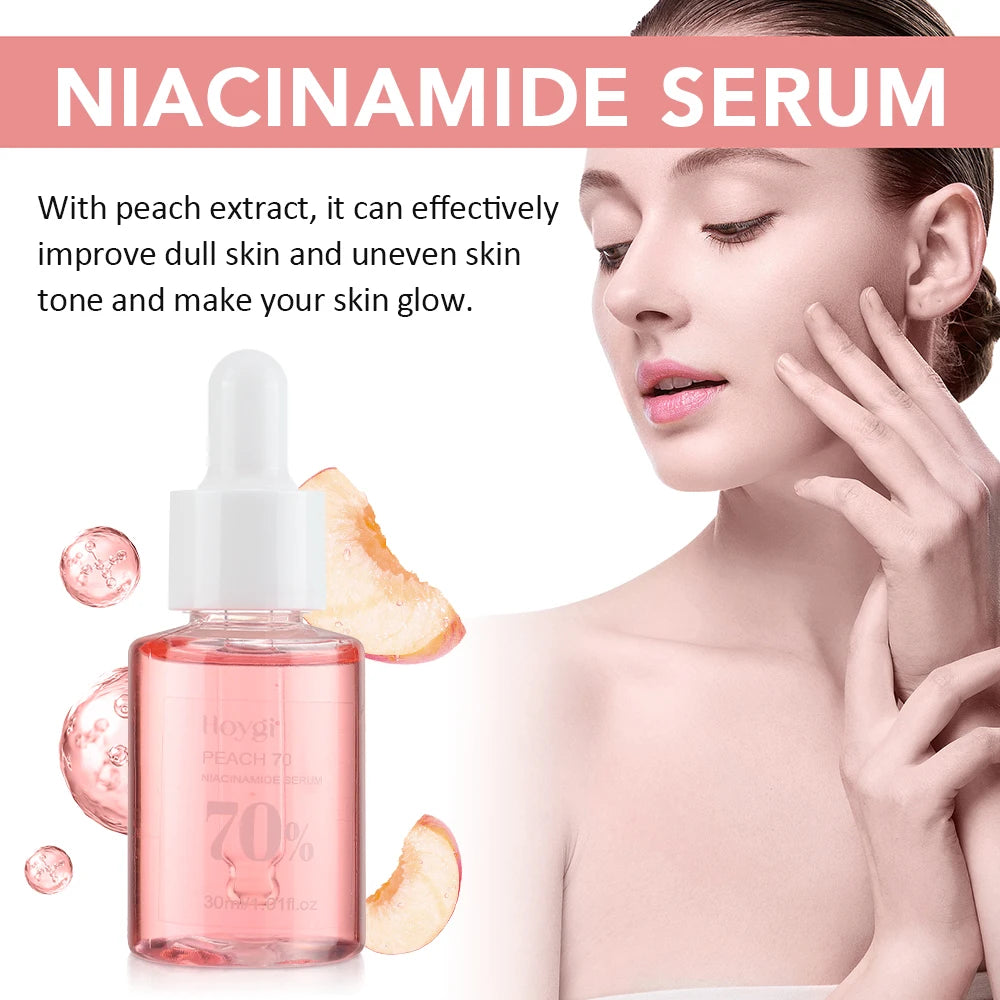 Niacinamide Face Serum 30ml – Dark Spot Corrector, Pore Minimizer & Brightening Skin Care