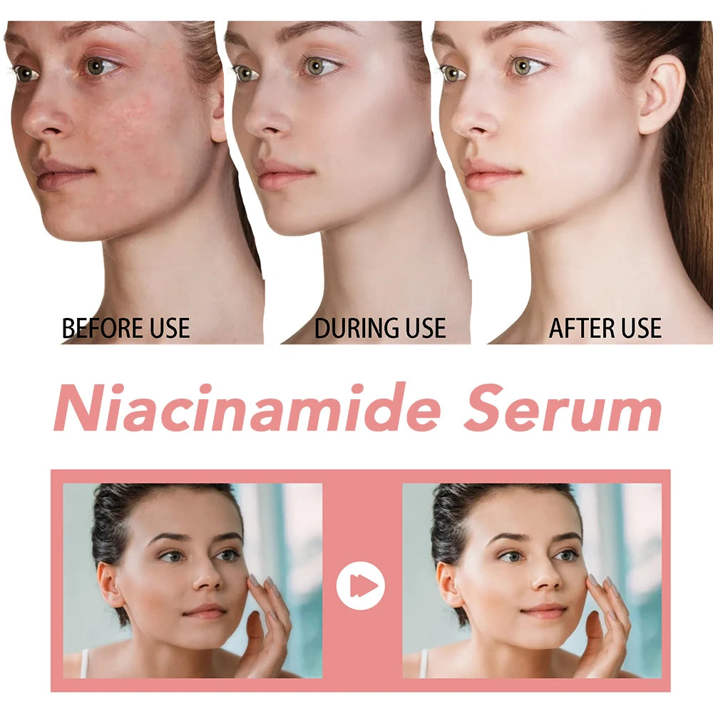 Niacinamide Face Serum 30ml – Dark Spot Corrector, Pore Minimizer & Brightening Skin Care