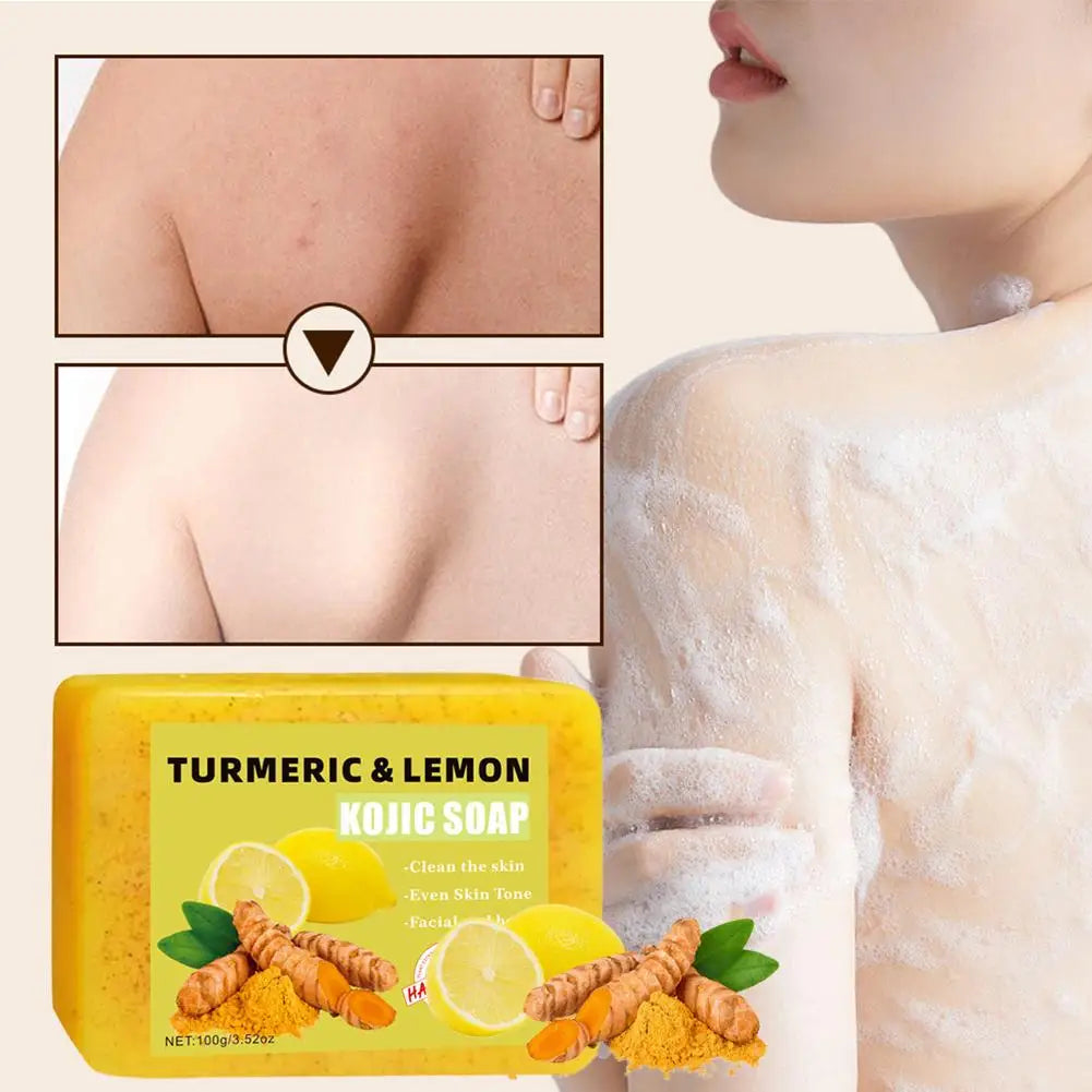 Lemon Turmeric Kojic Acid Soap Bar – 100g (1/2 PCS)