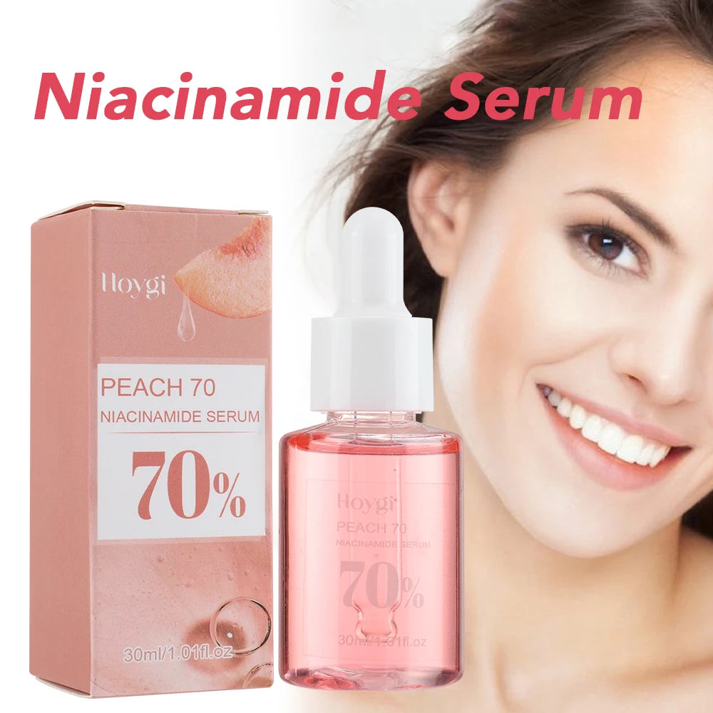 Niacinamide Face Serum 30ml – Dark Spot Corrector, Pore Minimizer & Brightening Skin Care