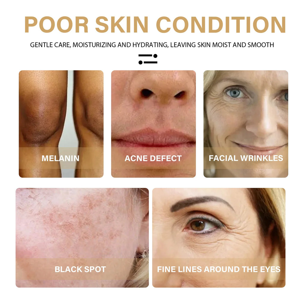 Turmeric Brightening Serum – Dark Spot Corrector & Skin Tone Enhancer