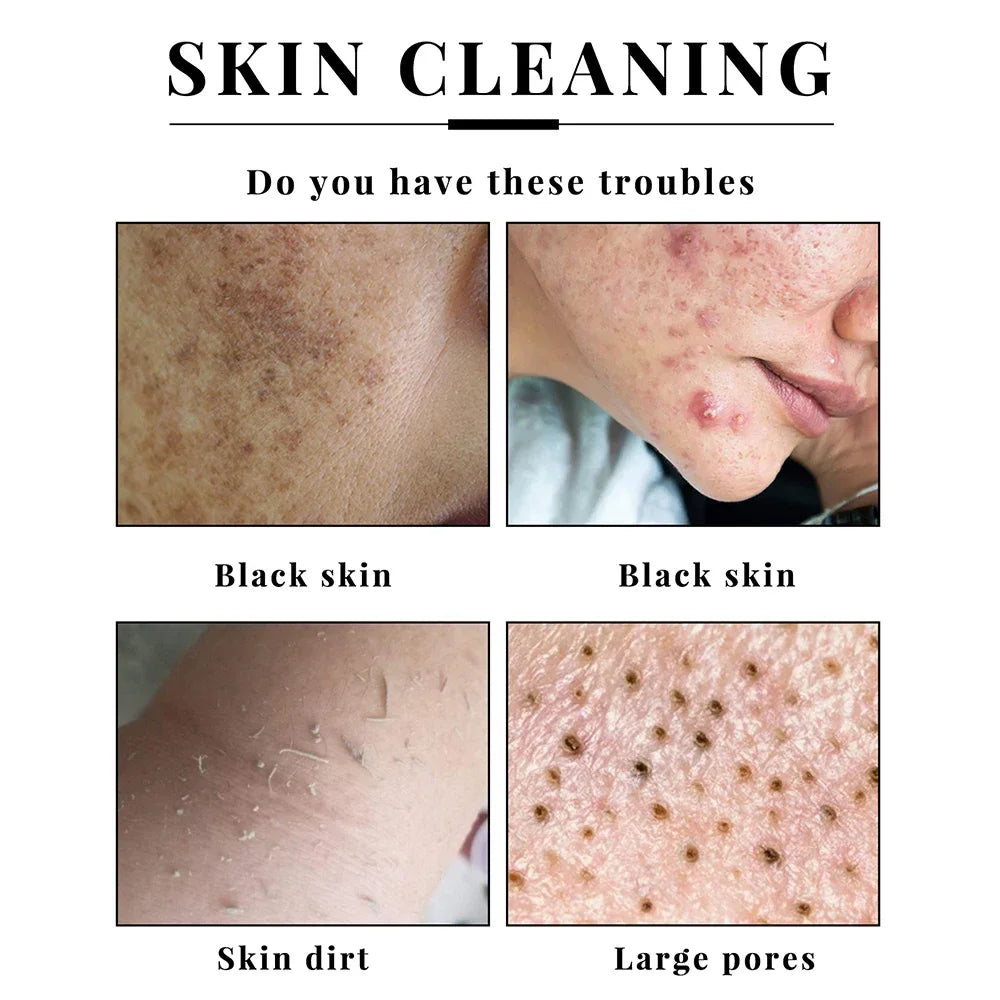 Handmade Kojic Acid Soap – Gentle Brightening & Exfoliating Face & Body Cleanser