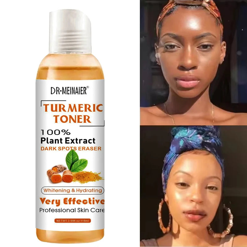 Turmeric Vitamin C Toner 118ml ,Brightening & Moisturizing Face Essence