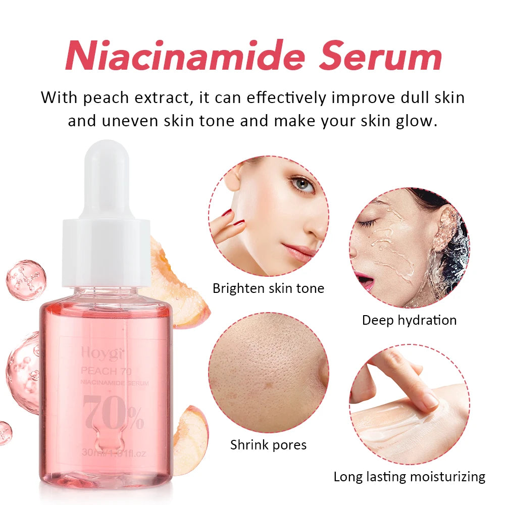 Niacinamide Face Serum 30ml – Dark Spot Corrector, Pore Minimizer & Brightening Skin Care